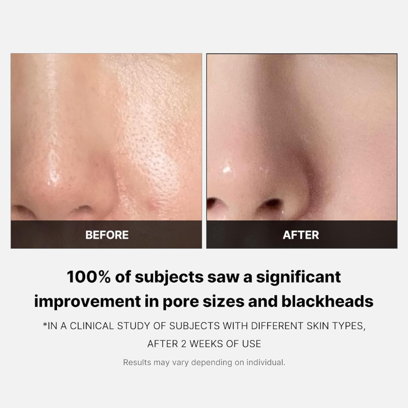 Medicube New Zero Pore Pad 2.0