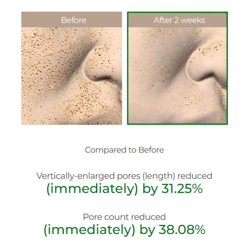 Microneedle Microcrystalline Essence White Pore Improvement 300 needles
