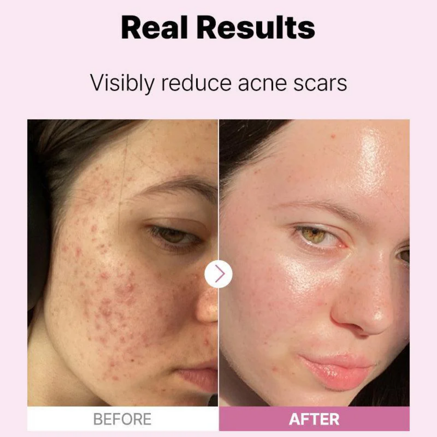 The Niacinamide 15 Serum
