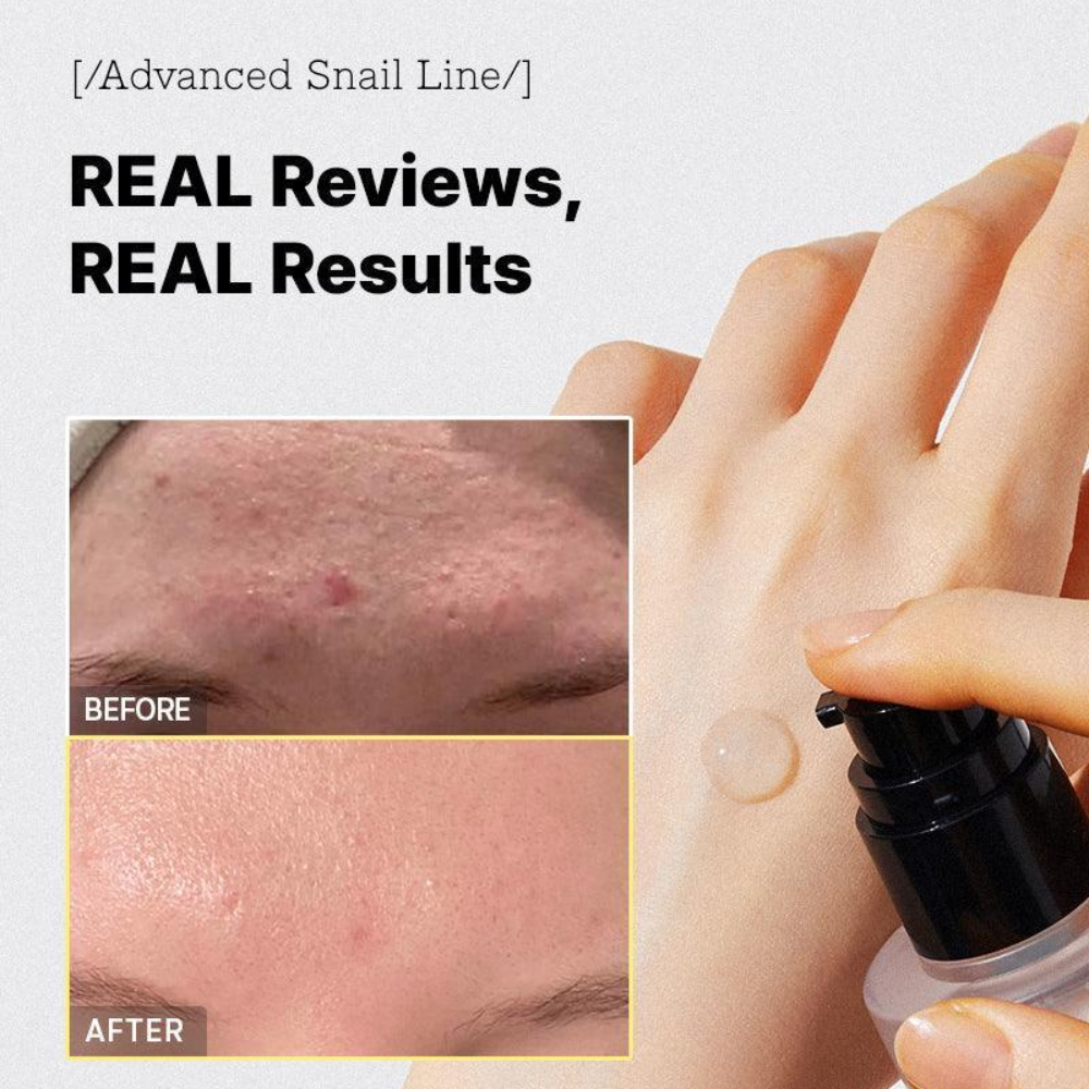 Advanced Snail 96 mucin Power Essence