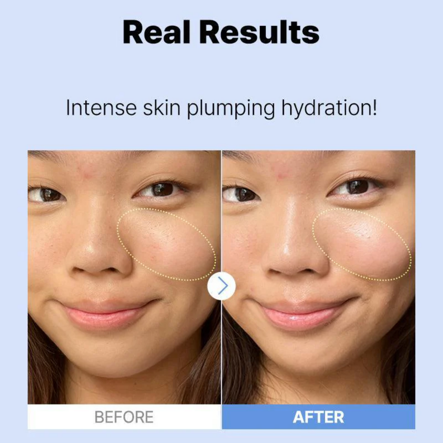 The Hyaluronic Acid 3 Serum