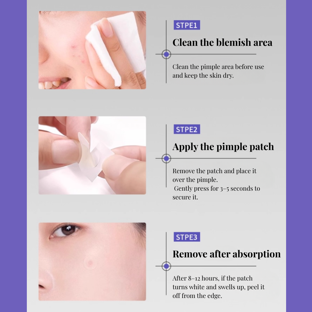 Holographic Star Acne Patches (60 Pieces)