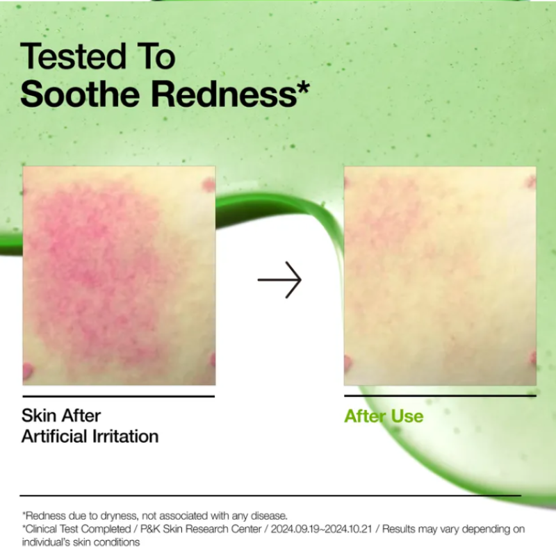 Azelaic Acid 10 Hyaluron Redness Soothing Serum 30ml