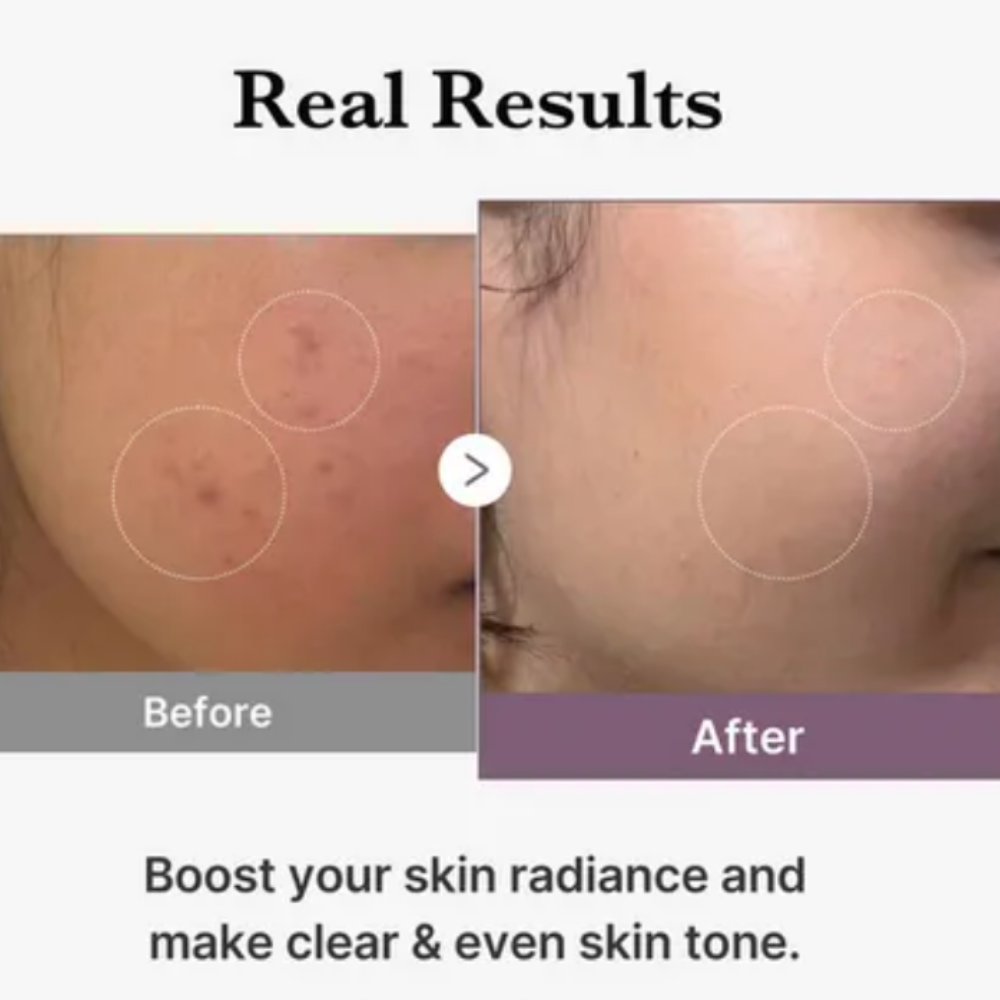 AGE-R Glutathione Glow Toner 140ml