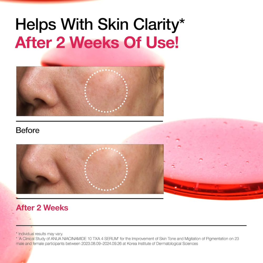 Niacinamide 10% + TXA 4% Serum NEW PACKAGING