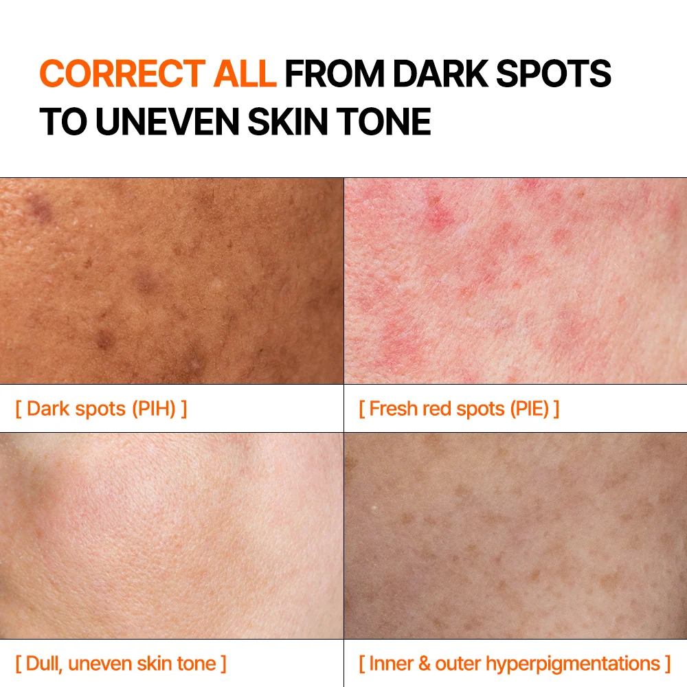 Mandelic Acid Dark Spot Glow Serum - 30ml