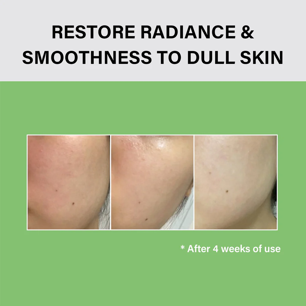 Noni Ampoule Calming + Radiance