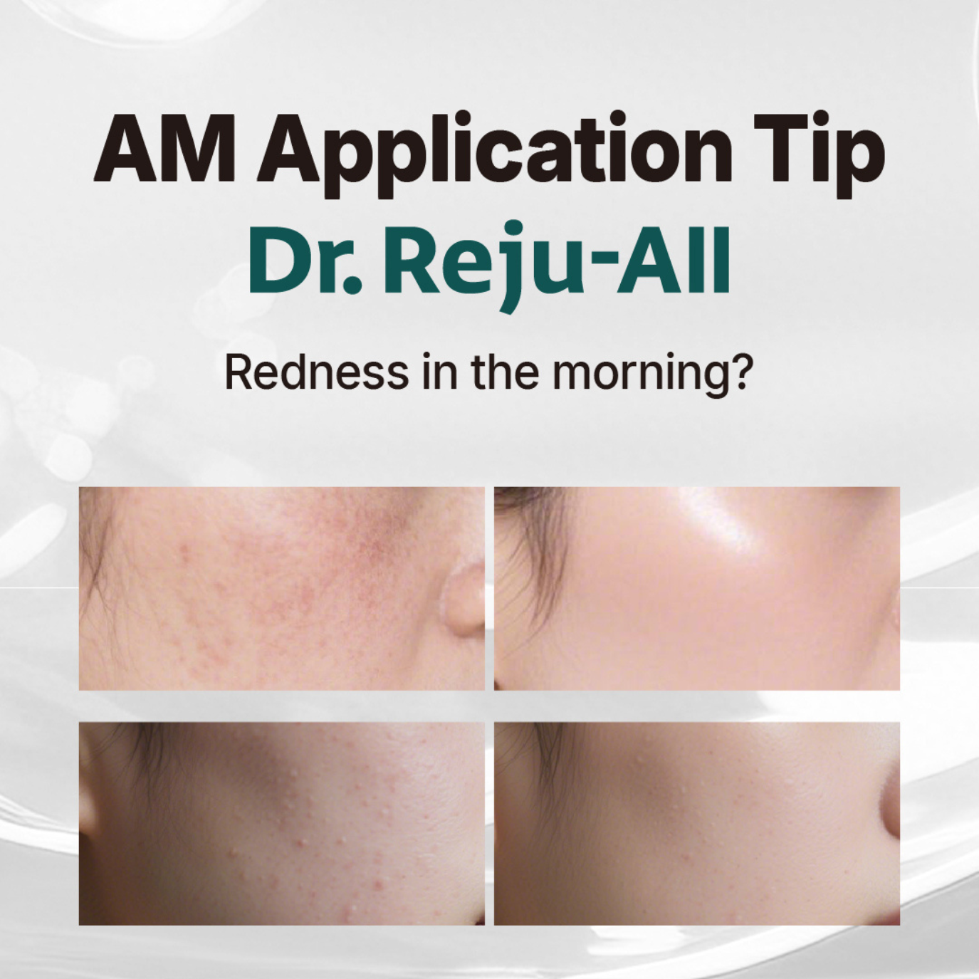 REJUALL Advanced PDRN Repair Cream