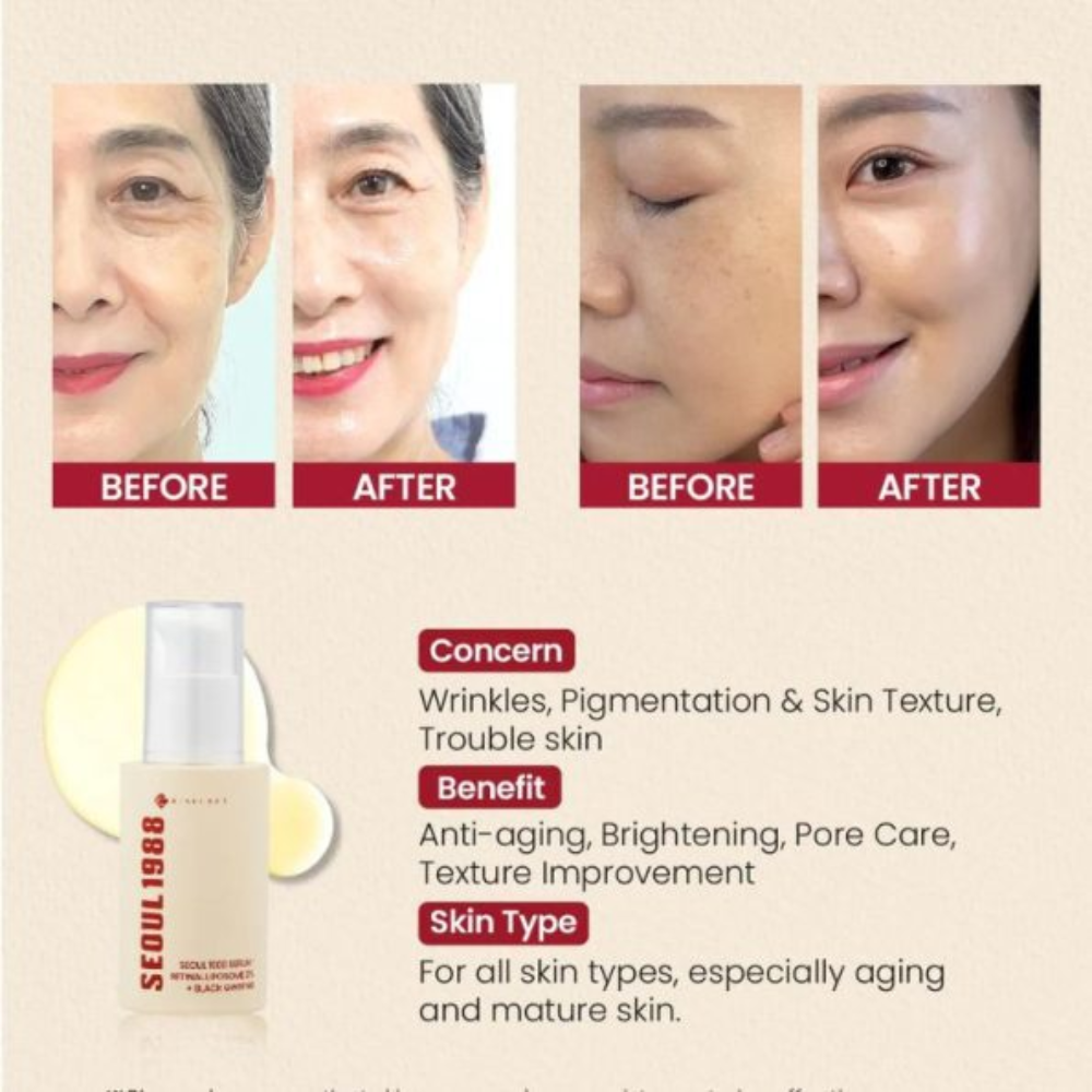 SEOUL 1988 Serum : Retinal Liposome 2% + Black Ginseng
