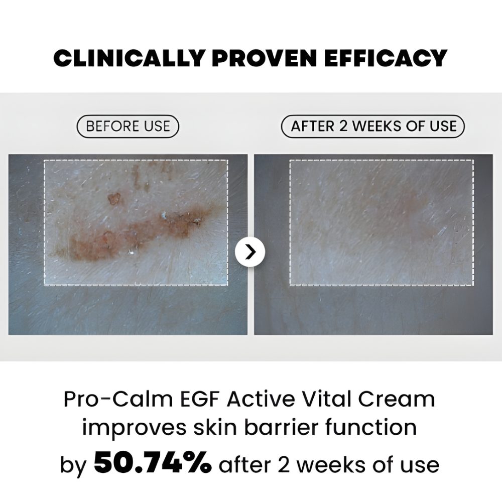 Hanmi Procalm EGF Active Vital Cream