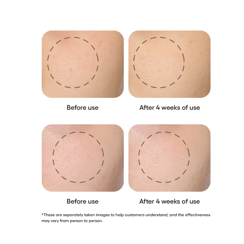 Perfect Renew 3X Advanced 2-Step Set