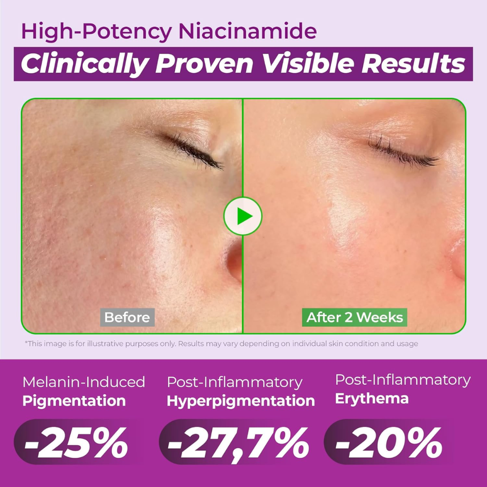 Niacinamide 20 Serum 40ml