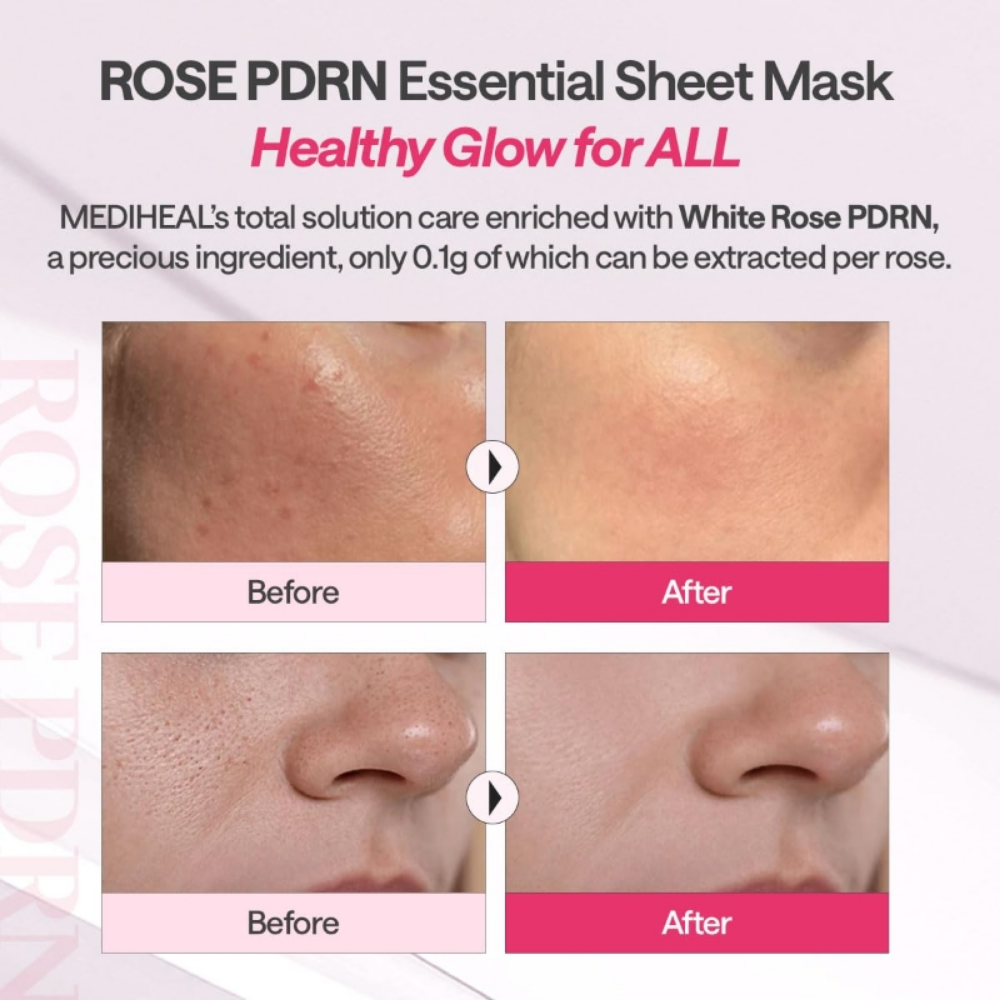 Rose PDRN Sheet Mask Pack  (10 + 1 Sheets)