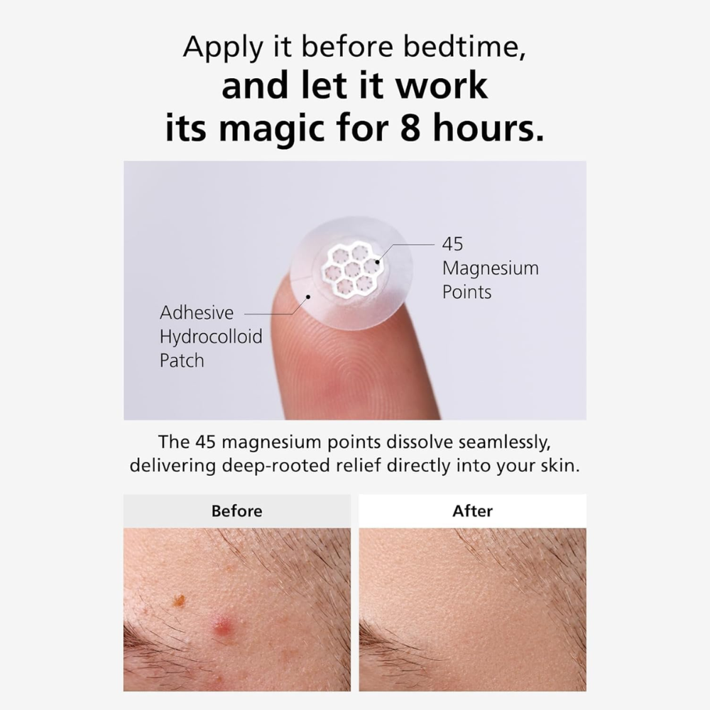 Easy Derm Quick Calming Pimple Patch