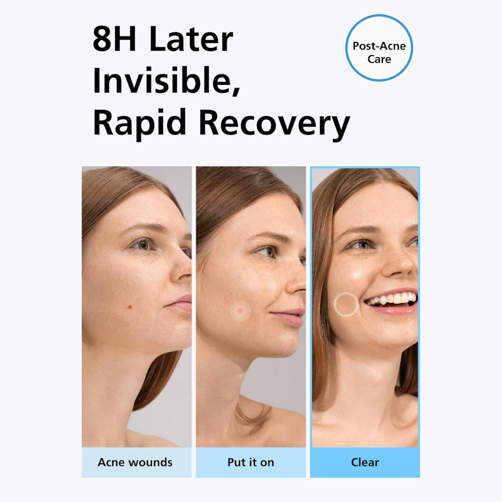 Easy Derm Beauty Pimple Patch