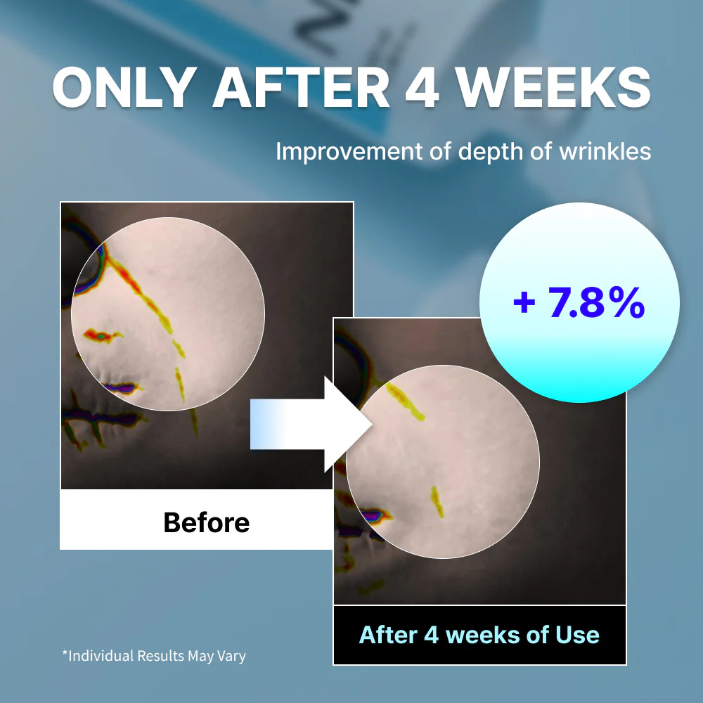 Youthful Formula Ultimate Moisturising Cream