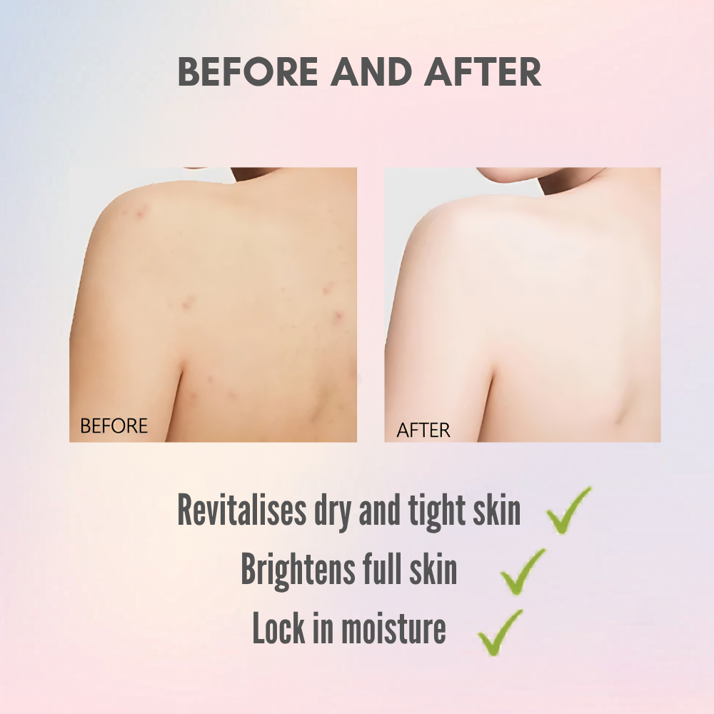 Vitamin E Body Lotion 300ml