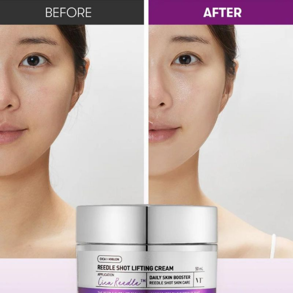 VT Reedle Shot  Lifting Cream 50ml