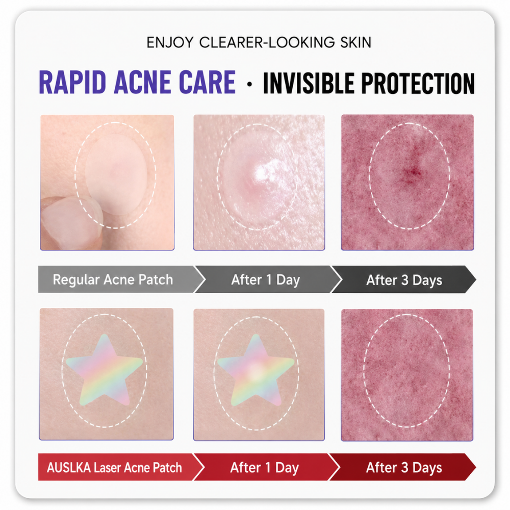 Holographic Vibrant Color Star Acne Patches (60 Pieces)