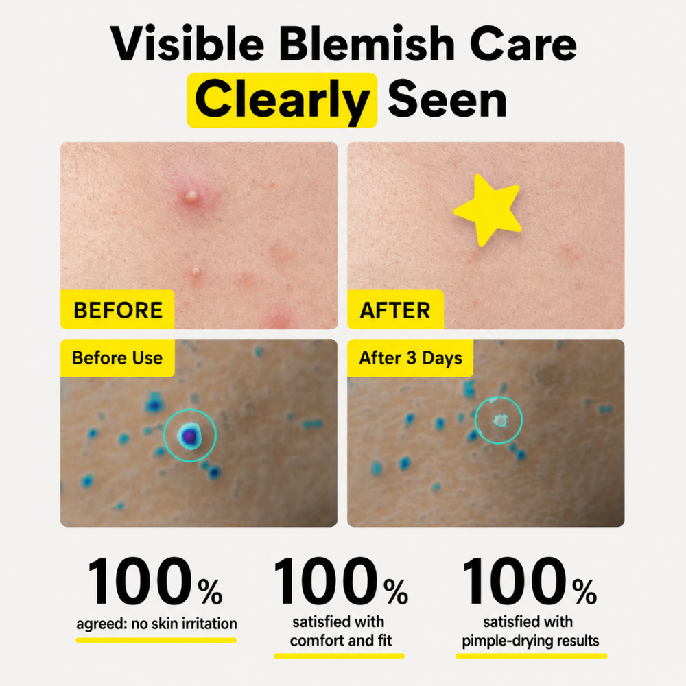 Holographic Yellow & Blue  Star Acne Patches