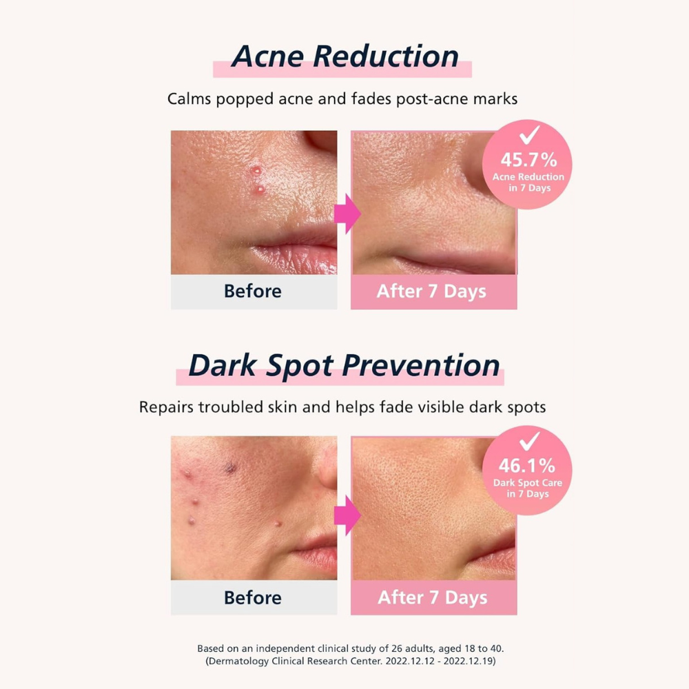 Easy Derm Real Calming Pimple Patch