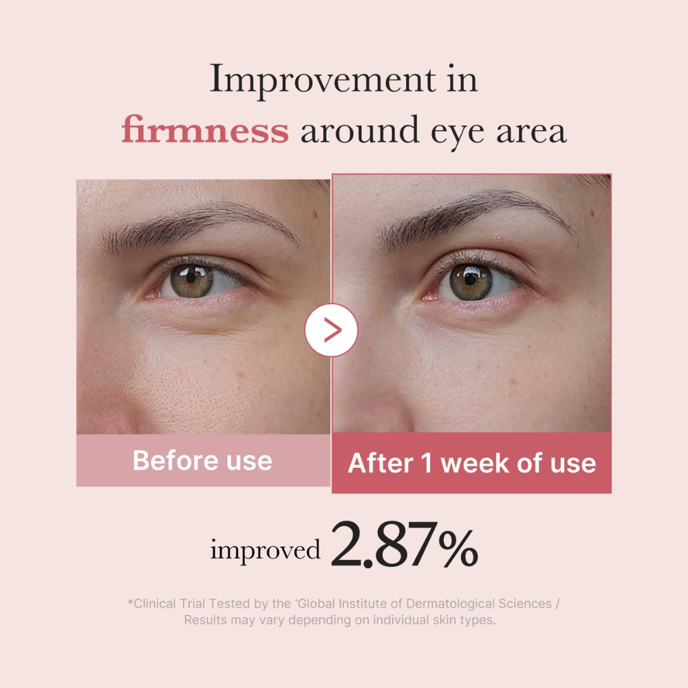 PDRN Pink Peptide Eye Cream - 30ml