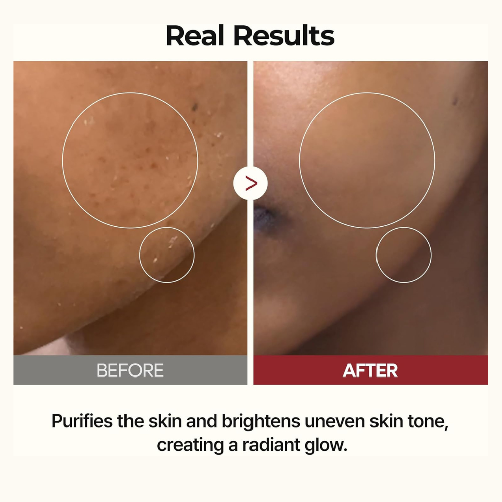 Peel Shot Glow White Rice Toner